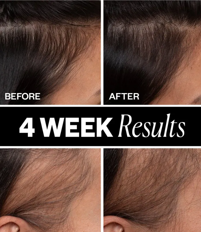 SPONSORED Hair Density Scalp Treatment IGK Hair Earrings SPONSORED Hair Density Scalp Treatment IGK Hair Earrings